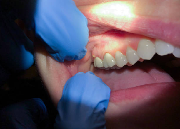  Perkins, OK Emergency Dentist Pros
